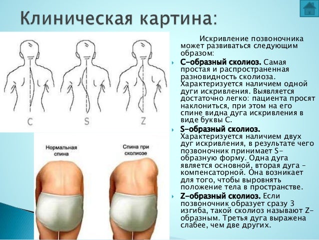 Болит спина! - Беременность - Форум Дети Боли в тазобедренном суставе Что делать, если болит